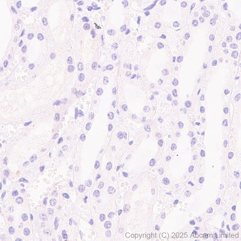 Immunohistochemistry (Formalin/PFA-fixed paraffin-embedded sections) - Anti-TIGIT antibody [EPR29350-46] (AB324237)