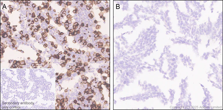 Immunohistochemistry (Formalin/PFA-fixed paraffin-embedded sections) - Anti-TIGIT antibody [EPR29350-46] (AB324237)