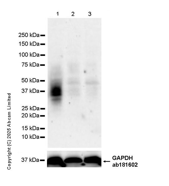 Western blot - Anti-TIGIT antibody [EPR29350-46] (AB324237), expandable thumbnail