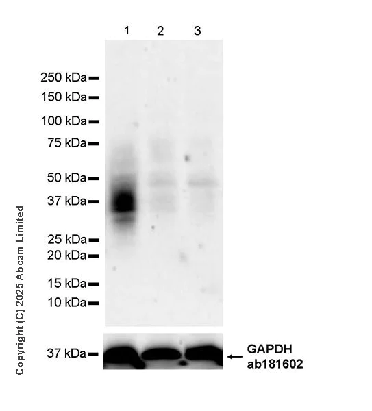 Western blot - Anti-TIGIT antibody [EPR29350-46] (AB324237)