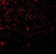 Immunocytochemistry/ Immunofluorescence - Anti-TIL/TLR1 antibody (AB37068)