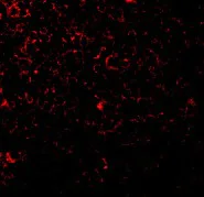 Immunocytochemistry/ Immunofluorescence - Anti-TIL/TLR1 antibody (AB37068)