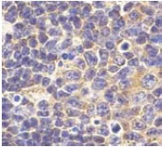 Immunohistochemistry (Formalin/PFA-fixed paraffin-embedded sections) - Anti-TIL/TLR1 antibody (AB37068)