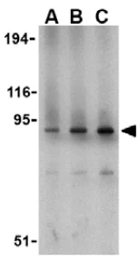 Western blot - Anti-TIL/TLR1 antibody (AB37068)
