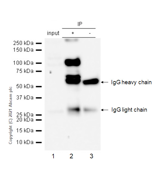 Immunoprecipitation - Anti-TIL/TLR1 antibody [EPR2075] (AB68158), expandable thumbnail