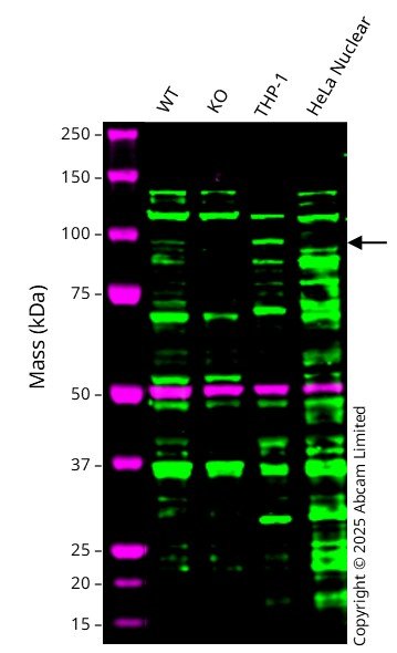 Western blot - Anti-TIL/TLR1 antibody [EPR2075] (AB68158)