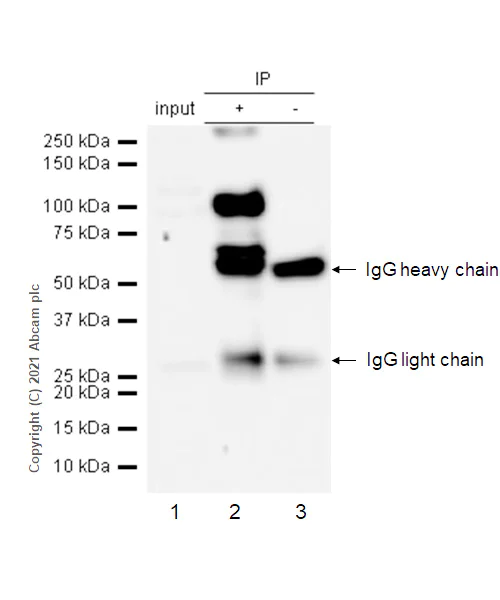 Immunoprecipitation - Anti-TIL/TLR1 antibody [EPR2075] - BSA and Azide free (AB239857)