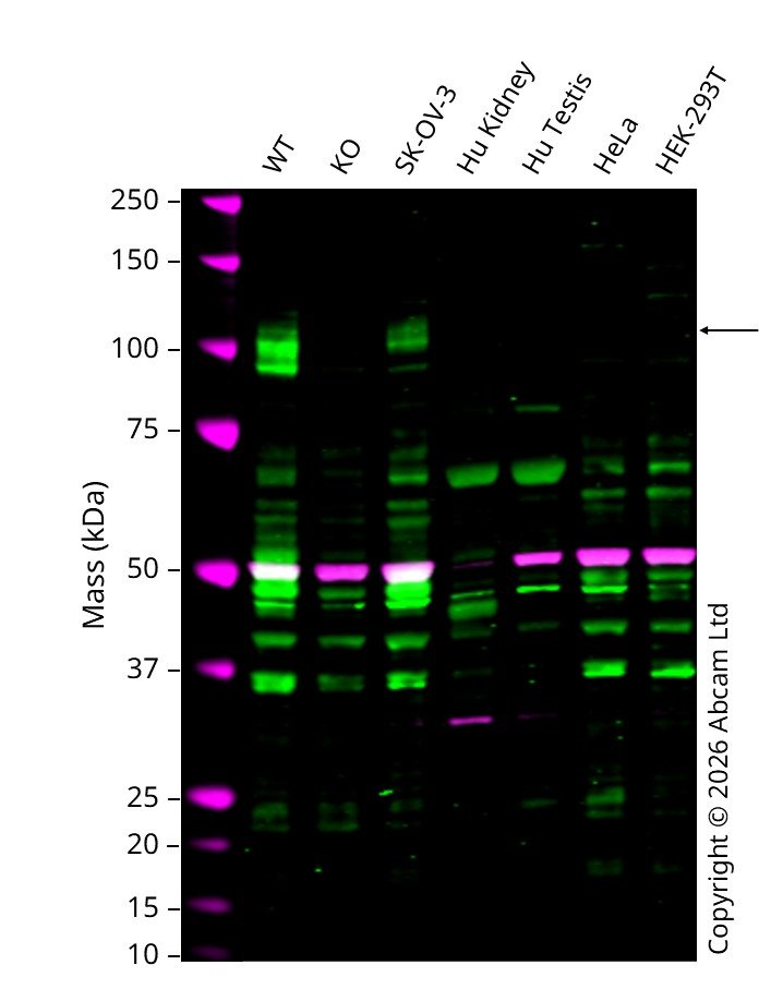 Western blot - Anti-TIM 1 antibody [3D9F5] (AB233720)