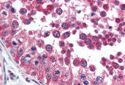 Immunohistochemistry (Formalin/PFA-fixed paraffin-embedded sections) - Anti-TIM 1 antibody (AB78494)