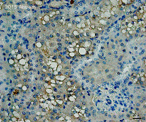 Immunohistochemistry (Formalin/PFA-fixed paraffin-embedded sections) - Anti-TIM 1 antibody (AB78494)