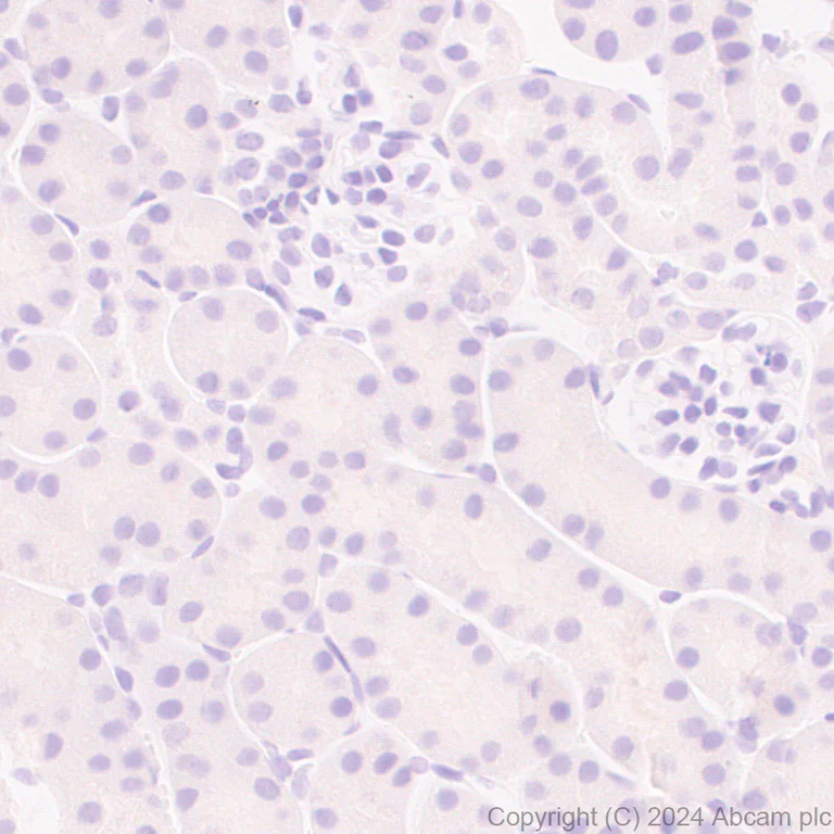 Anti-TIM 1 antibody [EPR28341-72] (ab316854) | Abcam