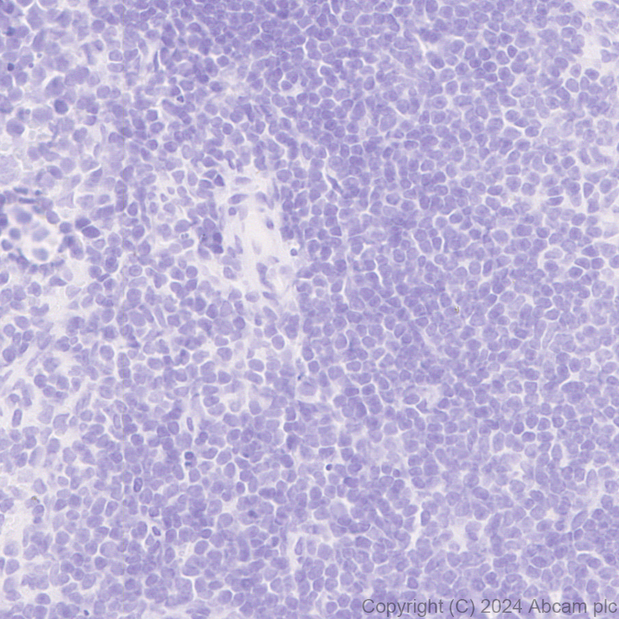 Immunohistochemistry (Formalin/PFA-fixed paraffin-embedded sections) - Anti-TIM 1 antibody [EPR28341-72] (AB316854)