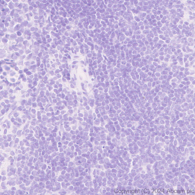 Immunohistochemistry (Formalin/PFA-fixed paraffin-embedded sections) - Anti-TIM 1 antibody [EPR28341-72] (AB316854)