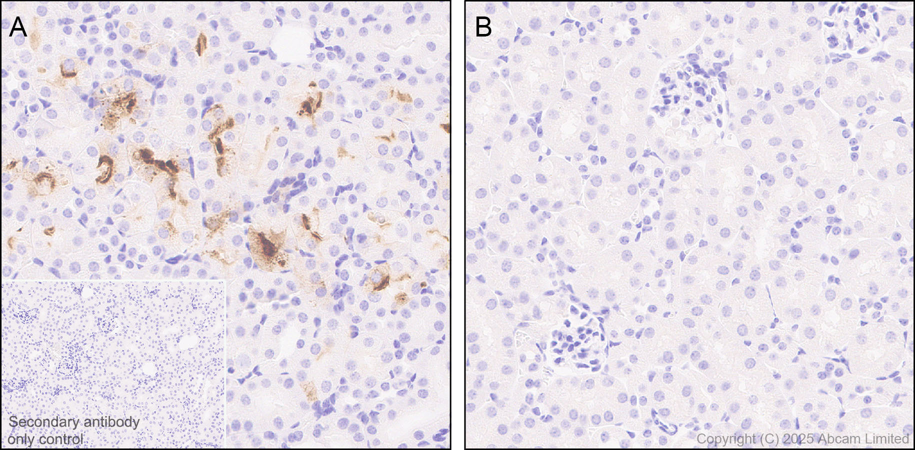 Immunohistochemistry (Formalin/PFA-fixed paraffin-embedded sections) - Anti-TIM 1 antibody [RM1294] (ab323414), expandable thumbnail