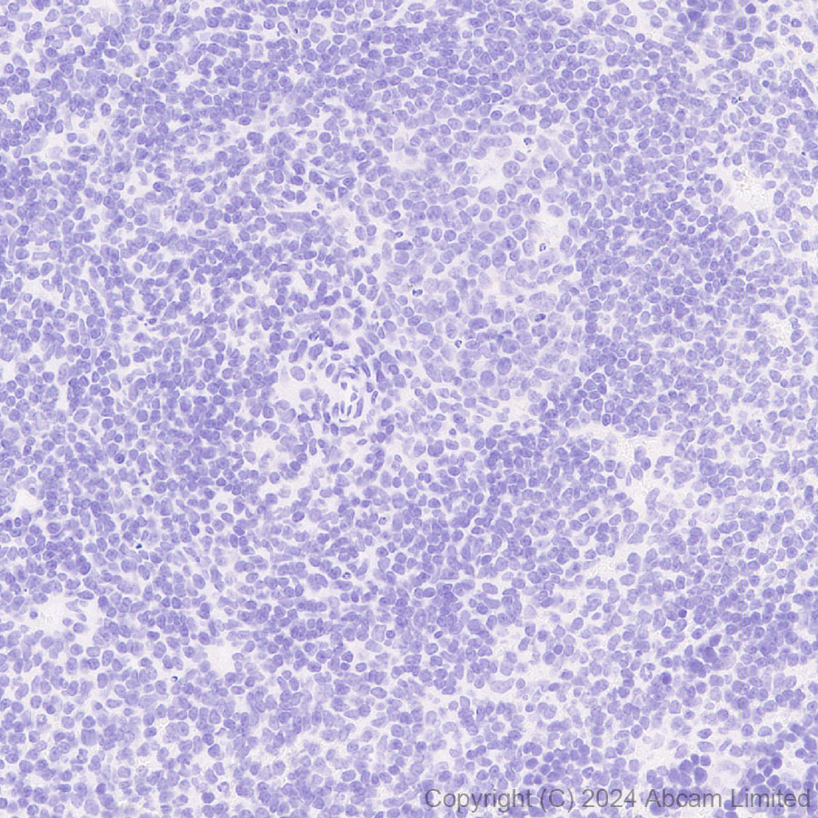 Immunohistochemistry (Formalin/PFA-fixed paraffin-embedded sections) - Anti-TIM 1 antibody [RM1294] (ab323414), expandable thumbnail