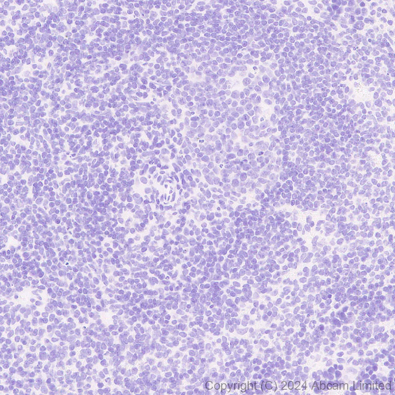 Immunohistochemistry (Formalin/PFA-fixed paraffin-embedded sections) - Anti-TIM 1 antibody [RM1294] (AB323414)