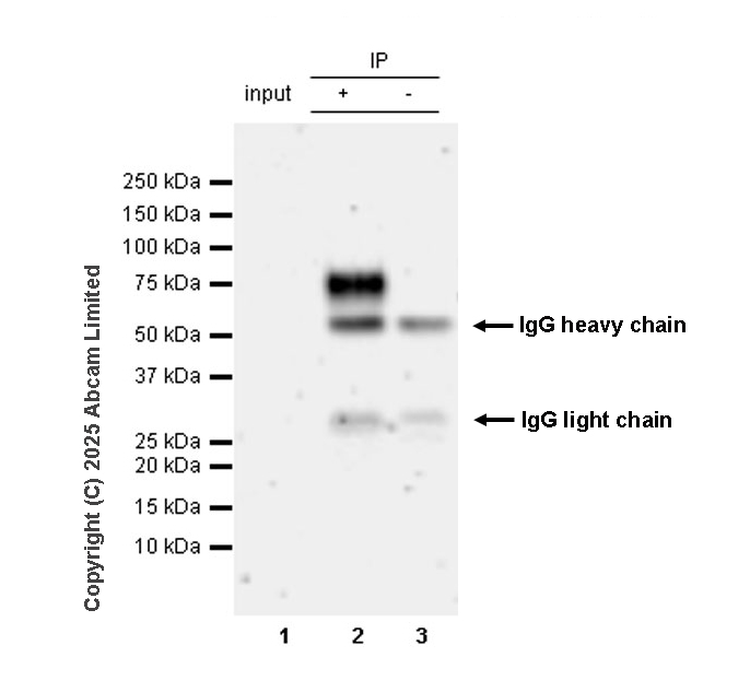 Immunoprecipitation - Anti-TIM 1 antibody [RM1294] (AB323414), expandable thumbnail