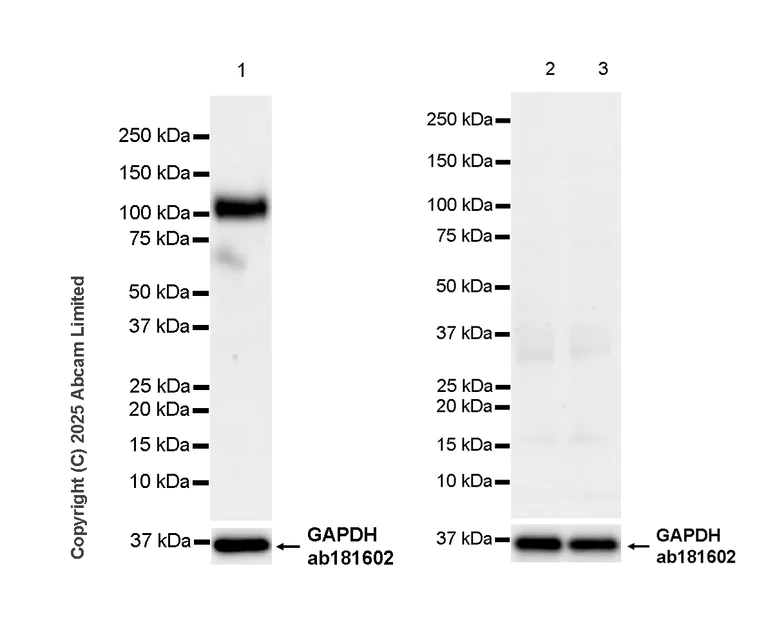 Western blot - Anti-TIM 1 antibody [RM1294] (AB323414)