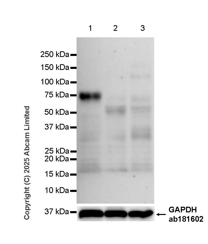 Western blot - Anti-TIM 1 antibody [RM1294] (ab323414), expandable thumbnail