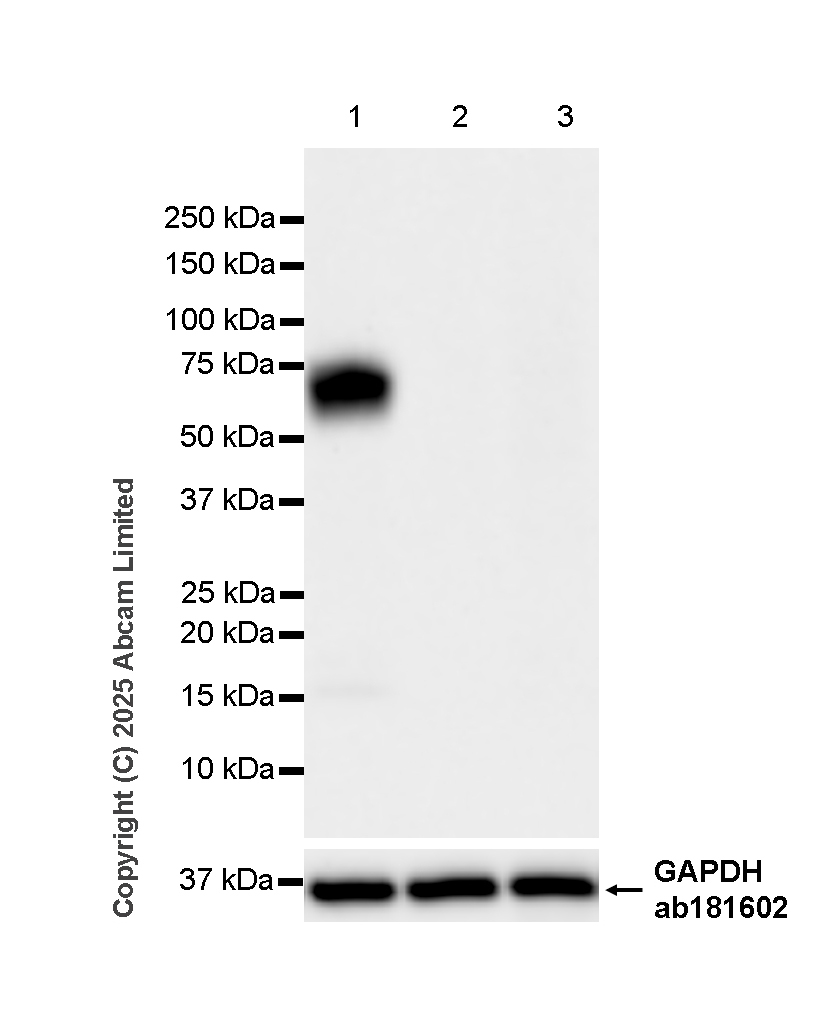 Western blot - Anti-TIM 1 antibody [RM1294] (AB323414), expandable thumbnail