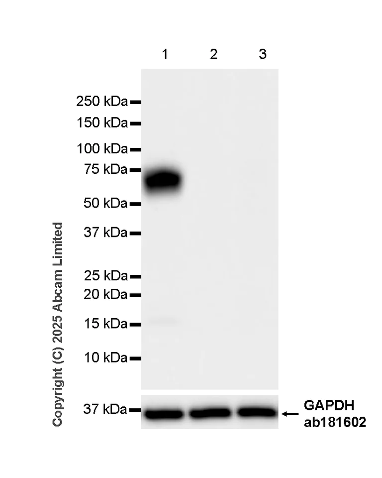 Western blot - Anti-TIM 1 antibody [RM1294] (AB323414)