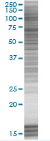 TIM 1 overexpression 293T lysate (whole cell)