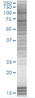 SDS-PAGE - TIM 1 overexpression 293T lysate (whole cell) (AB94224)