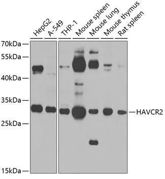 Western blot - Anti-TIM 3 antibody (AB185703)