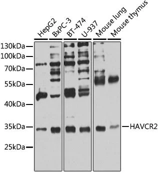 Western blot - Anti-TIM 3 antibody (AB185703)