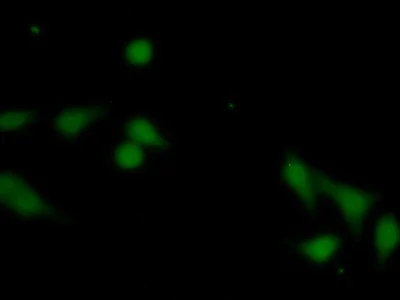 Immunocytochemistry/ Immunofluorescence - Anti-TIM 3 antibody (AB233228)