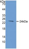 Western blot - Anti-TIM 3 antibody (AB233228)