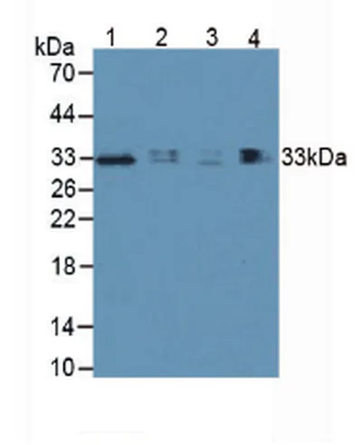 Western blot - Anti-TIM 3 antibody (AB233228)