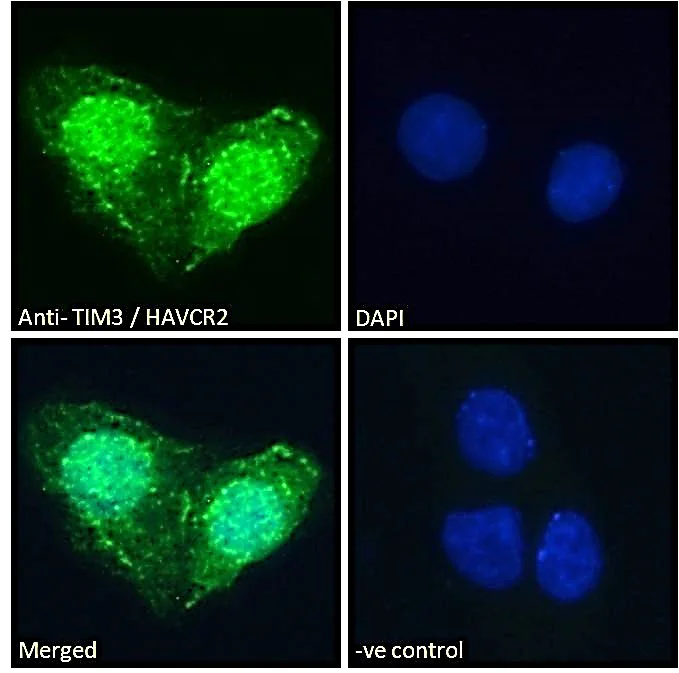 Immunocytochemistry/ Immunofluorescence - Anti-TIM 3 antibody (AB47997)