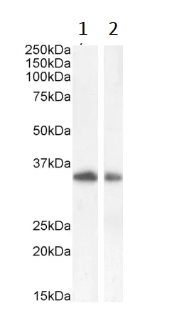Western blot - Anti-TIM 3 antibody (AB47997)