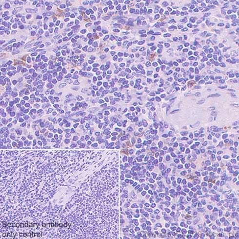 Immunohistochemistry (Formalin/PFA-fixed paraffin-embedded sections) - Anti-TIM 3 antibody [CAL69] (AB246852), expandable thumbnail