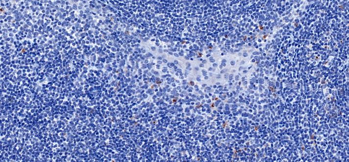 Immunohistochemistry (Formalin/PFA-fixed paraffin-embedded sections) - Anti-TIM 3 antibody [CAL69] (AB246852), expandable thumbnail