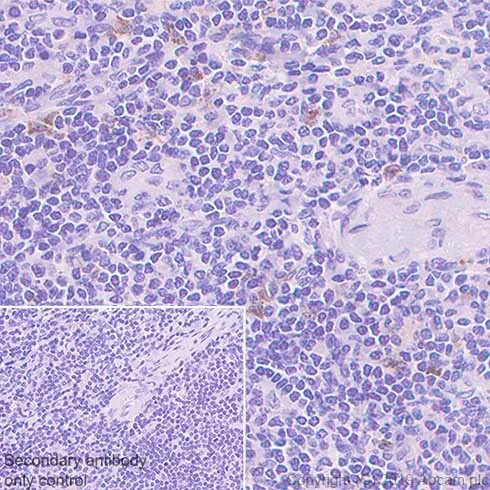 Immunohistochemistry (Formalin/PFA-fixed paraffin-embedded sections) - Anti-TIM 3 antibody [CAL69] - BSA and Azide free (AB252214)