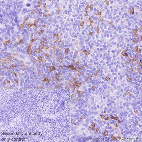 Immunohistochemistry (Formalin/PFA-fixed paraffin-embedded sections) - Anti-TIM 3 antibody [EPR22241] (AB241332)
