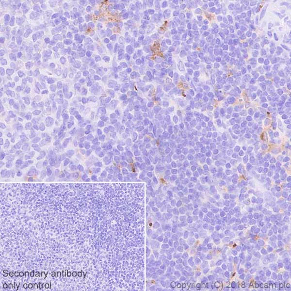 Immunohistochemistry (Formalin/PFA-fixed paraffin-embedded sections) - Anti-TIM 3 antibody [EPR22241] (AB241332)