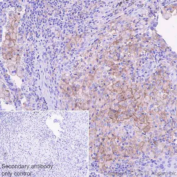 Immunohistochemistry (Formalin/PFA-fixed paraffin-embedded sections) - Anti-TIM 3 antibody [EPR22241] - BSA and Azide free (AB242080)