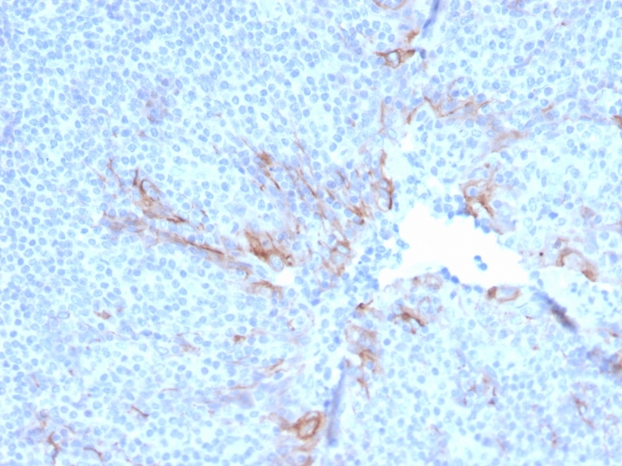 Immunohistochemistry (Formalin/PFA-fixed paraffin-embedded sections) - Anti-TIM 3 antibody [TIM3/3113] (AB268138), expandable thumbnail