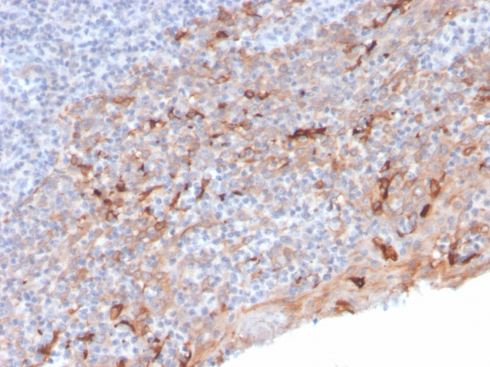 Immunohistochemistry (Formalin/PFA-fixed paraffin-embedded sections) - Anti-TIM 3 antibody [TIM3/3113] (AB268138), expandable thumbnail
