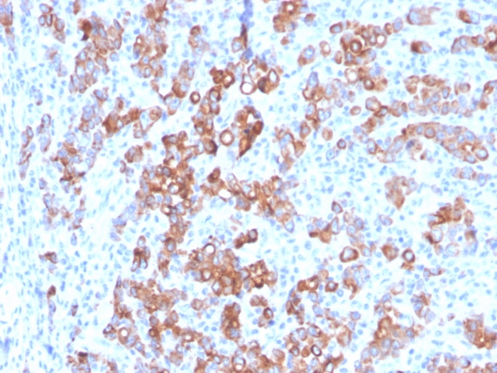 Immunohistochemistry (Formalin/PFA-fixed paraffin-embedded sections) - Anti-TIM 3 antibody [TIM3/3113] (AB268138), expandable thumbnail
