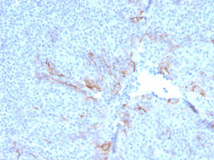 Immunohistochemistry (Formalin/PFA-fixed paraffin-embedded sections) - Anti-TIM 3 antibody [TIM3/3113] - BSA and Azide free (AB268262)