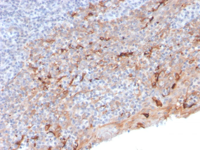 Immunohistochemistry (Formalin/PFA-fixed paraffin-embedded sections) - Anti-TIM 3 antibody [TIM3/3113] - BSA and Azide free (AB268262)