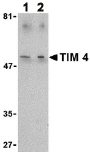 Western blot - Anti-TIM 4 antibody (AB47636), expandable thumbnail