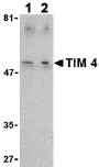 Western blot - Anti-TIM 4 antibody (AB47636)