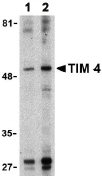 Western blot - Anti-TIM 4 antibody (AB47637)