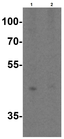Western blot - Anti-TIM 4 antibody (AB47637)