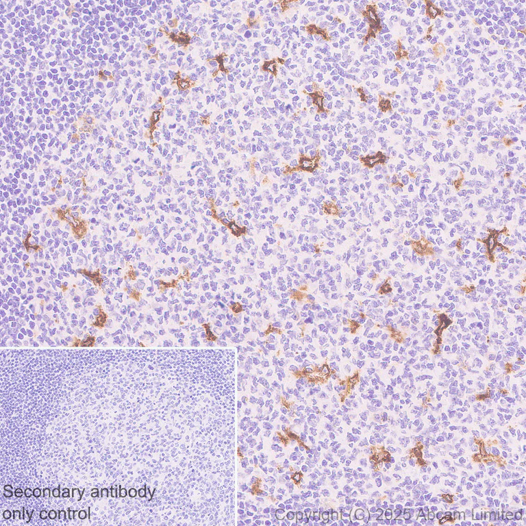 Immunohistochemistry (Formalin/PFA-fixed paraffin-embedded sections) - Anti-TIM 4 antibody [EPR29500-15] (AB323572)